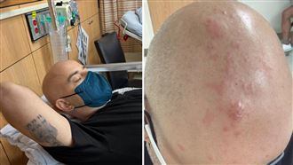 吳鳳染惡疾治療現況曝　讚台灣：健保完善