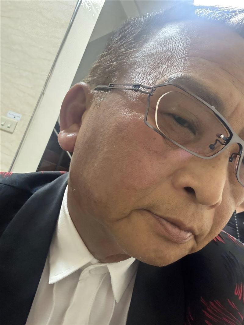 孔鏘透露面部浮腫。（圖／翻攝自孔鏘臉書）
