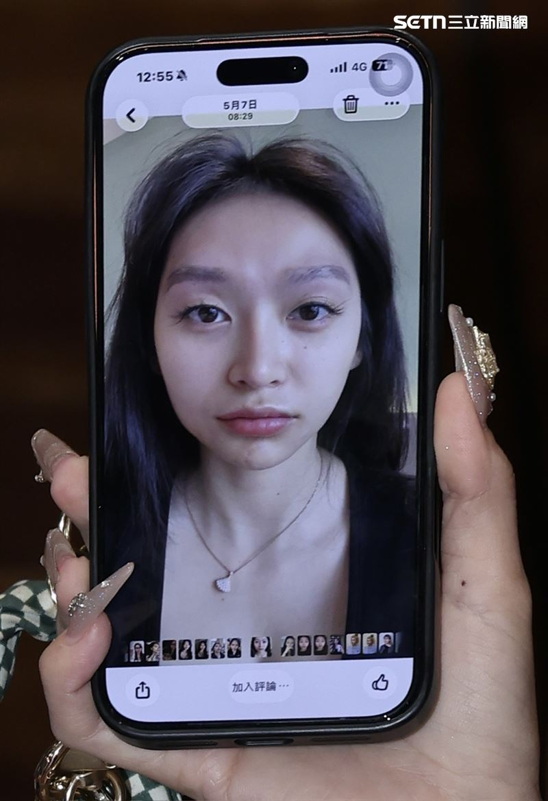 祈錦鈅笑說自己做醫美後臉腫變成食蟻獸。(圖/記者鄭孟晃攝影)