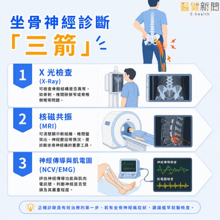 腰腿痛到走不動？坐骨神經痛的治療「三箭」。（圖／醫健新聞網提供）