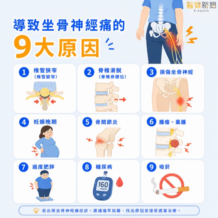 腰腿痛到走不動？導致坐骨神經痛的9大原因。（圖／醫健新聞網提供）