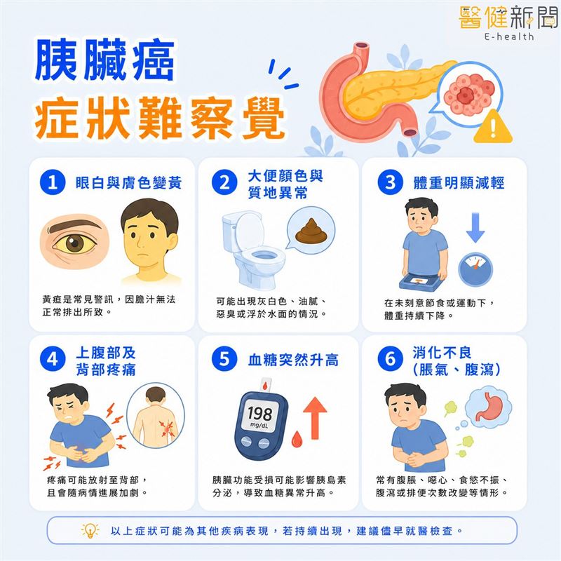 胰臟癌有「癌王」之稱，原因在於早期症狀不易察覺，九成患者確診時已為晚期！國衛院發現新標靶MAP4K2。（圖／國衛院提供）