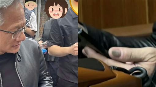 黃仁勳灰指甲引熱議！醫師曝5大可能原因