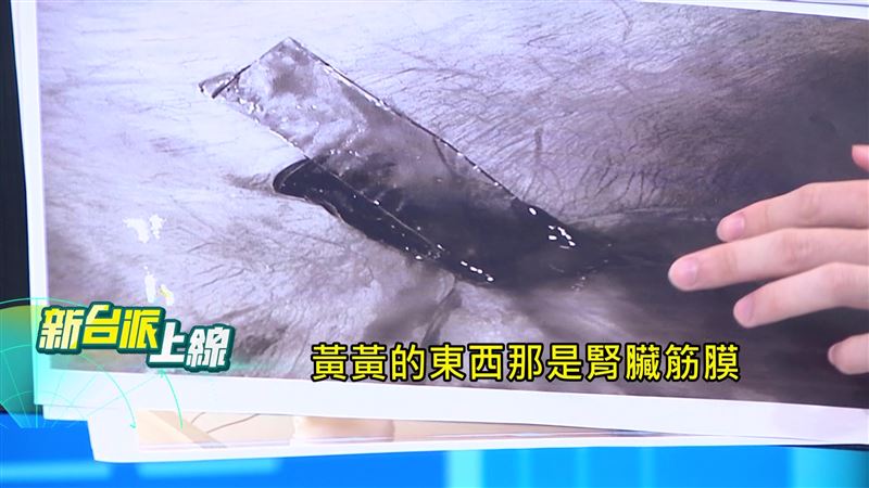 陳聖文以自身經歷召開記者會揭露密室逃脫公安危機，台北市府卻毫無作為，最終釀成悲劇。（圖／新台派上線）