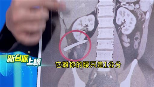 卸責中央自打臉　 他揭蔣萬安怠惰真相
