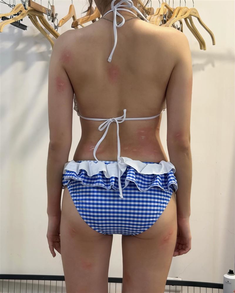 瑟七曝光一張背影照,被蚊子叮得超慘,背部、腰部、大腿與手臂佈滿紅腫包。(圖/翻攝自Threads @__seul777)