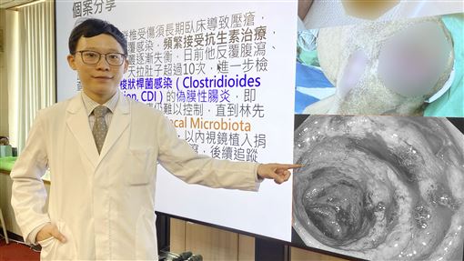 新聞封面