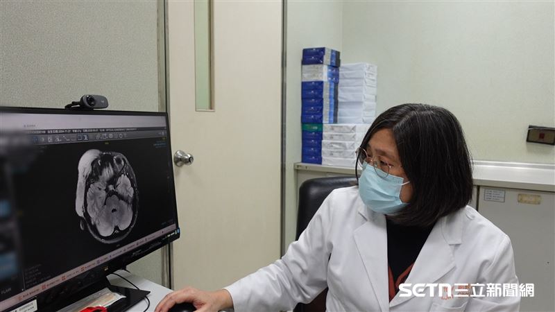 目前腫瘤已經嚴重影響了羽桂的右眼視力、聽力，甚至連說話都有些吃力。對她來說，這腫瘤不僅影響了她的外觀，更影響了她的器官功能和生活。（圖／記者張雅筑攝）