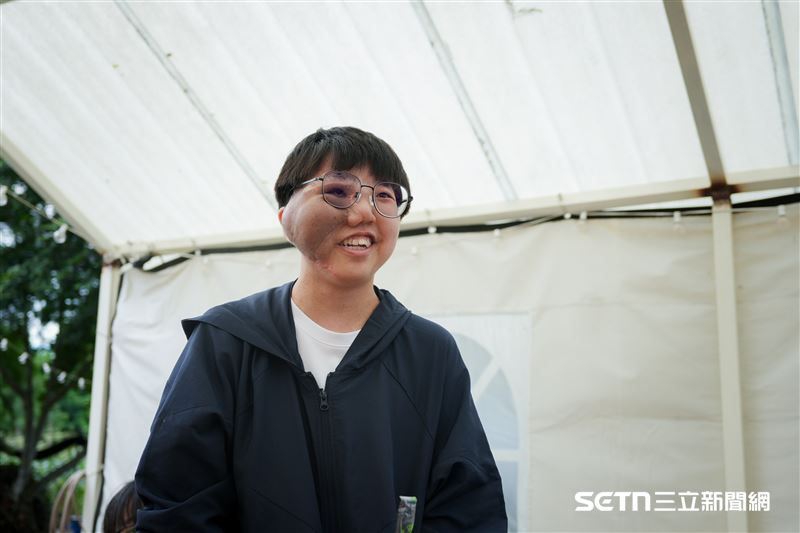 談及成長過程，羽桂坦言或多或少會經歷一些取難聽綽號，或被以不禮貌口吻提問的時候。年紀還小的時候，面對那些異樣眼光與刺耳話語，其實也會覺得很受傷，甚至會默默把情緒藏在心裡，不知道該怎麼面對。但隨著年紀漸長，她慢慢學會與自己相處，也開始明白，別人的眼光不該決定自己的人生。「我沒有做錯什麼，也不是因為我不好才生病。」她坦然地說。比起一直困在別人的評價裡，她更想把時間留給真正重要的人事物，好好過生活、做自己想做的事。（圖／羅慧夫顱顏基金會授權提供）