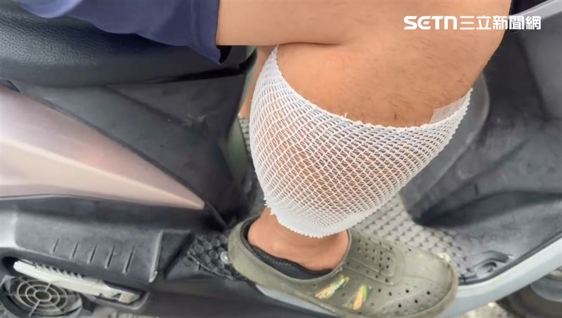 當時火鍋店老闆站在邊緣,右腿遭貨車擦撞,受傷送醫。(圖/翻攝畫面)