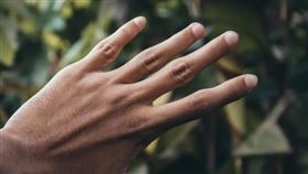黃軒提醒若某種指甲變化持續存在、越來越明顯、合併疲倦、喘、體重下降、疼痛等症狀，應盡快就醫諮詢。（示意圖／Pixabay）