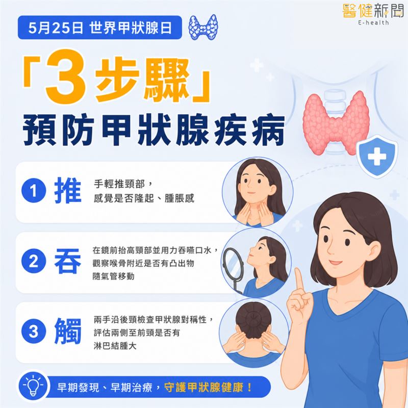 5月25日世界甲狀腺日／簡單「3步驟」揪病灶，預防甲狀腺疾病！。（圖／醫健新聞網提供）