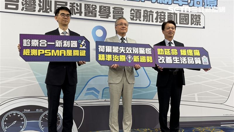 攝護腺癌一驗就晚期　做1事死亡率降27％