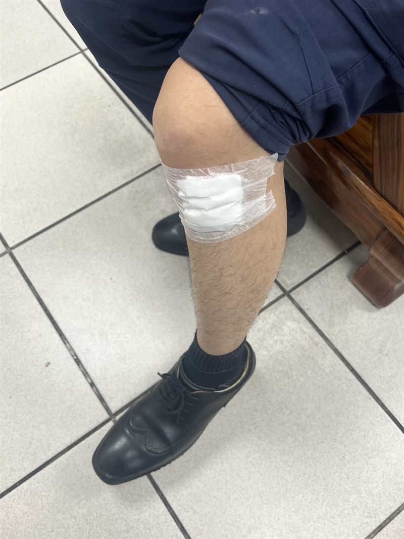 執勤警遭撞後受傷情形。(圖/翻攝畫面)
