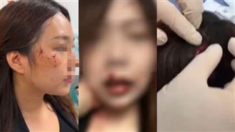 自家貓突然暴走！她遭貓咪瘋狂攻擊滿臉血