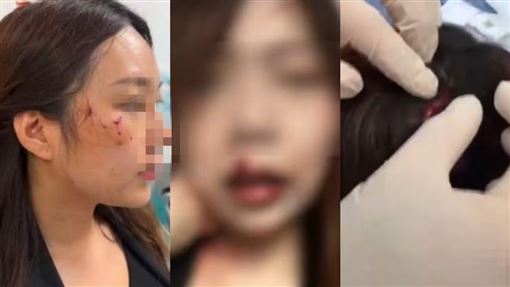 自家貓突然暴走！她遭貓咪瘋狂攻擊滿臉血
