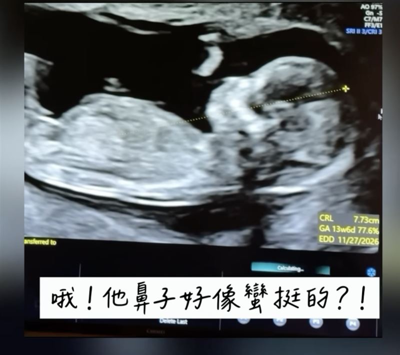 熊熊宣布二寶是男孩。(圖/翻攝自臉書)