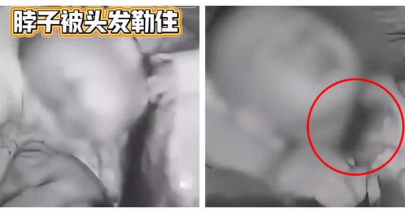 山東一名男童睡夢中遭母親長髮纏住脖子，險些發生窒息意外。（圖／翻攝自后浪視頻）