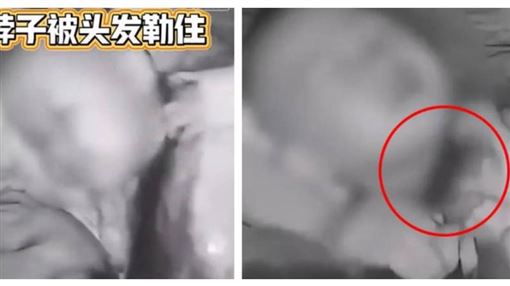 長髮成凶器！2歲童睡到快沒氣　母撕髮救