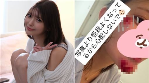 性感女優「車禍毀容！」下巴重創鮮血直流