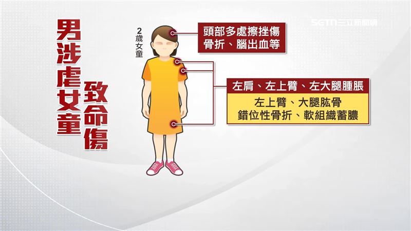 女童萱萱，頭部多處擦挫傷、骨折以及腦出血，加上壞死的組織碎屑，多重傷勢引發敗血症死亡