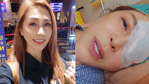 56歲八點檔女星急手術！右眼視力突跌0.5