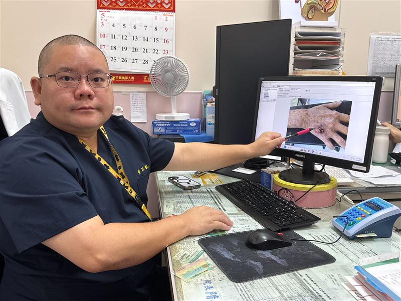 老翁長期泌尿感染，導致罹患身體四處罹患尿管癌、膀胱癌、皮膚癌，相當罕見。(圖／李綜合醫院提供)