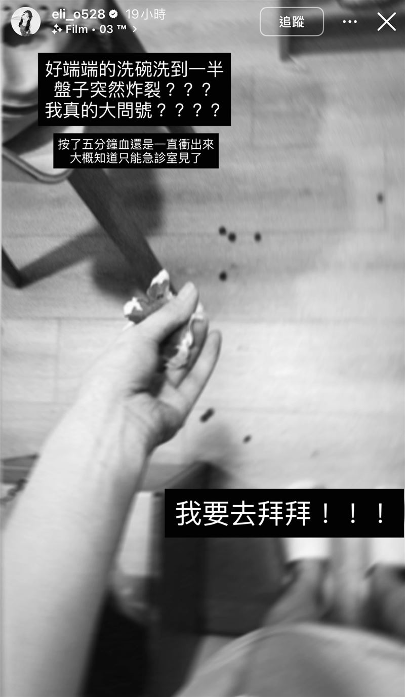 倪暄被盤子割傷手指。（圖／翻攝自IG）
