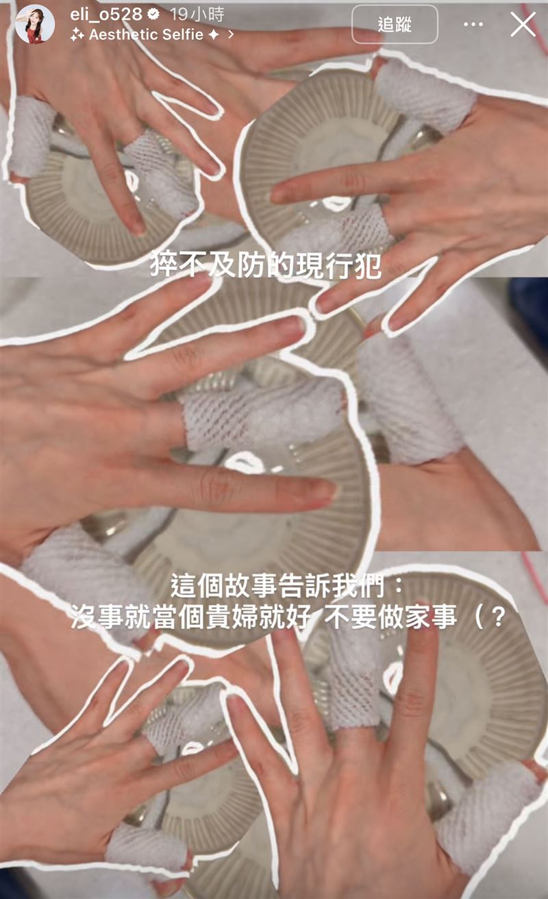 倪暄傷勢曝光。（圖／翻攝自IG）