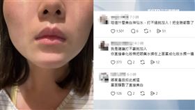 獨家／眼藥水美白？女滴完膚色變白　網歪樓：想敷臉