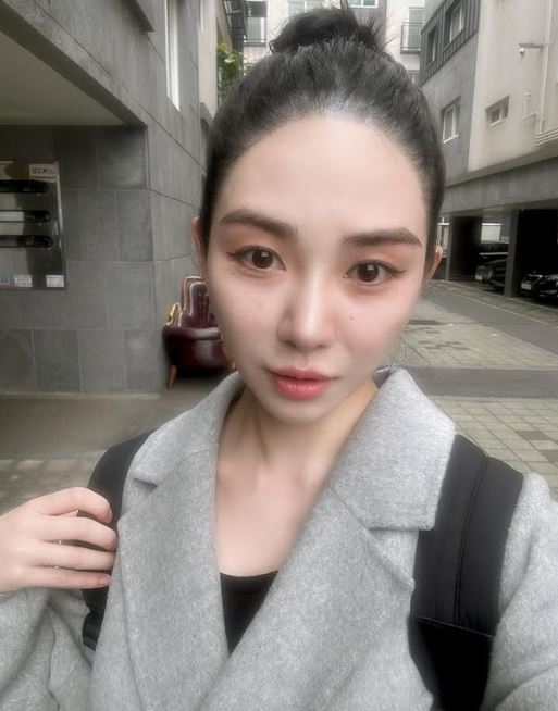 權珉娥2月遇到醫療糾紛。（圖／翻攝自IG）