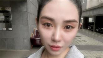 珉娥醫美遇意外臉遭燒傷　仍留嚴重疤痕
