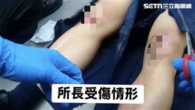  毒駕,所長,輪胎,喪屍煙彈,雙腳,骨折,手術,倒車,（圖／翻攝畫面）