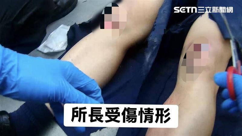 新/警遭輾斷腿…喪屍竟獲「無保請回」