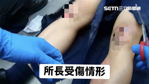 新／毒駕輾斷警雙腿無保請回　原裁定撤銷