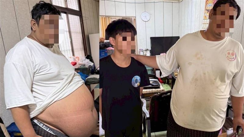 獨家/來不及陪兒到18歲!肝硬化巨肚爸逝