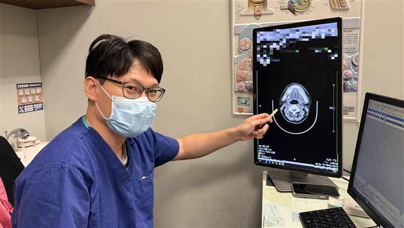 他唾液腺結石進食劇痛 醫:不愛喝水害的