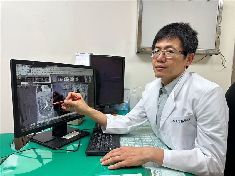 醫師表示,主動脈剝離典型症狀多為突發性胸痛或背痛,但若病灶延伸至腹部血管,就可能以腹痛表現,但容易被忽略。(圖/署立豐原醫院提供)