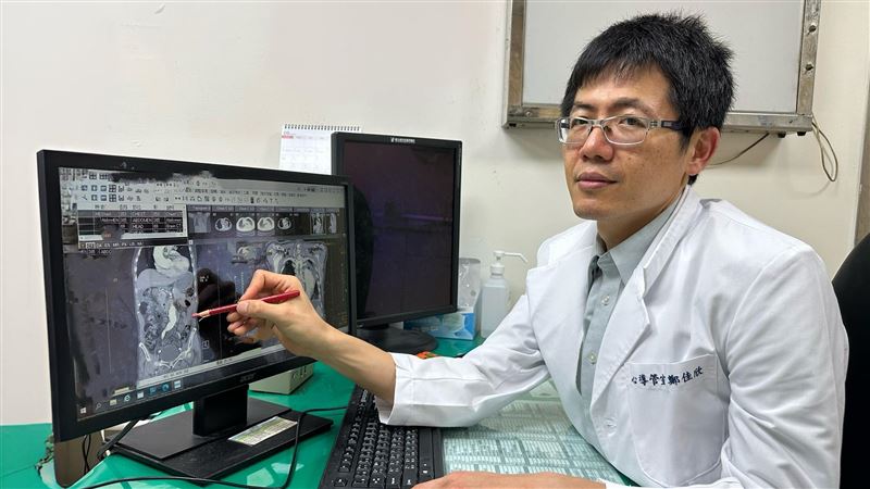 78歲翁復健突劇烈腹痛 主動脈竟剝離5CM