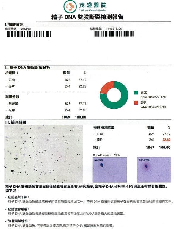 43歲職軍丈夫因壓力太大、常熬夜,精子DNA雙股斷裂,導致求子無望。(圖/茂盛醫院提供)