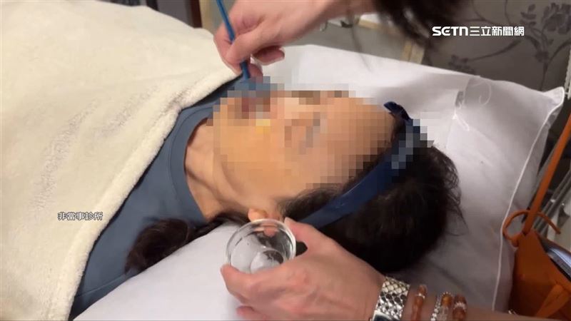 高雄一名女子到皮膚科診所做果酸換膚，結果美容師拿錯濃度拿成70%，臉部嚴重灼傷毀容