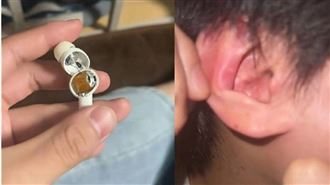 熱銷藍牙耳機深夜突炸裂　男大生耳鳴就醫