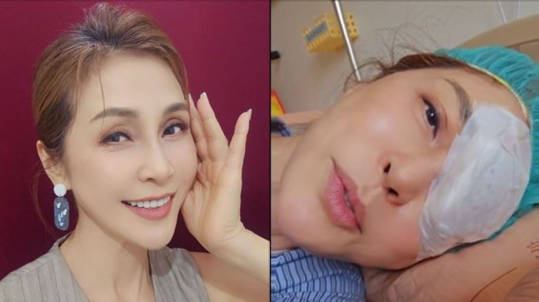 梁佑南右眼剩0.5　看劇本全霧掉急開刀