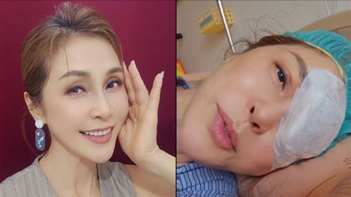梁佑南右眼剩0.5　看劇本全霧掉急開刀
