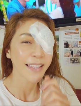 醫師通常會依照視力狀況評估是否手術。若視力仍維持在0.8至0.9,通常以定期追蹤為主ㄝ若視力降至0.4以下,則可考慮接受手術治療。(圖/翻攝自梁佑南FB)