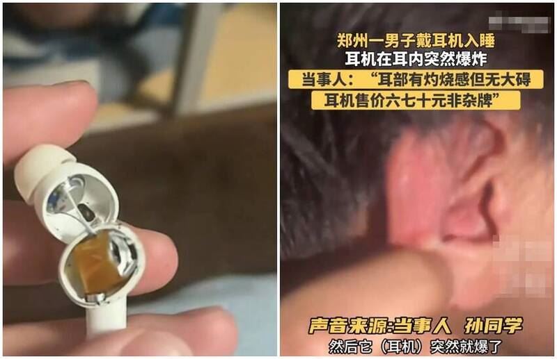一名中國男大生使用電商平台熱銷耳機時,耳機竟在耳內爆炸。(圖/翻攝自@李老師不是你老師)