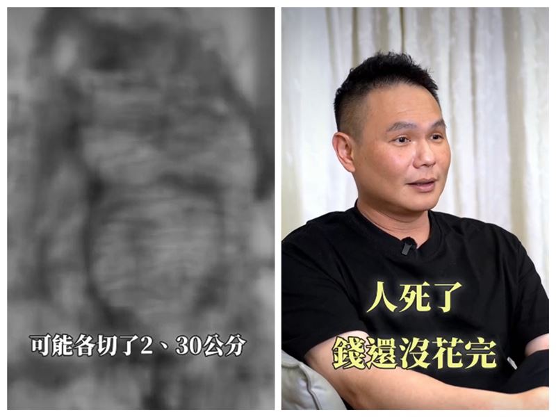 超哥曝罹癌治療狀況。(圖/翻攝自超派人生臉書)