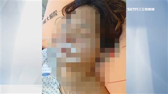 獨／單挑變圍毆！男中埋伏遭7煞砍進ICU
