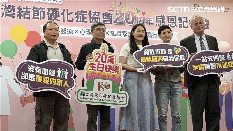 腹痛竟藏27cm腫瘤 女罹罕病結節硬化症