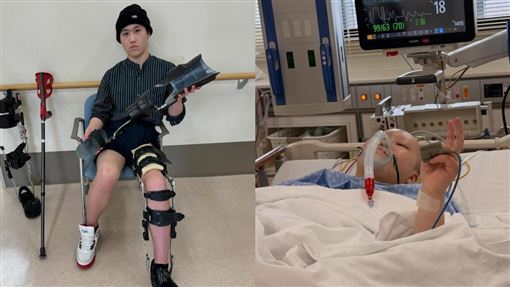 年僅21歲　知名YTR驚罹罕病骨肉瘤病逝